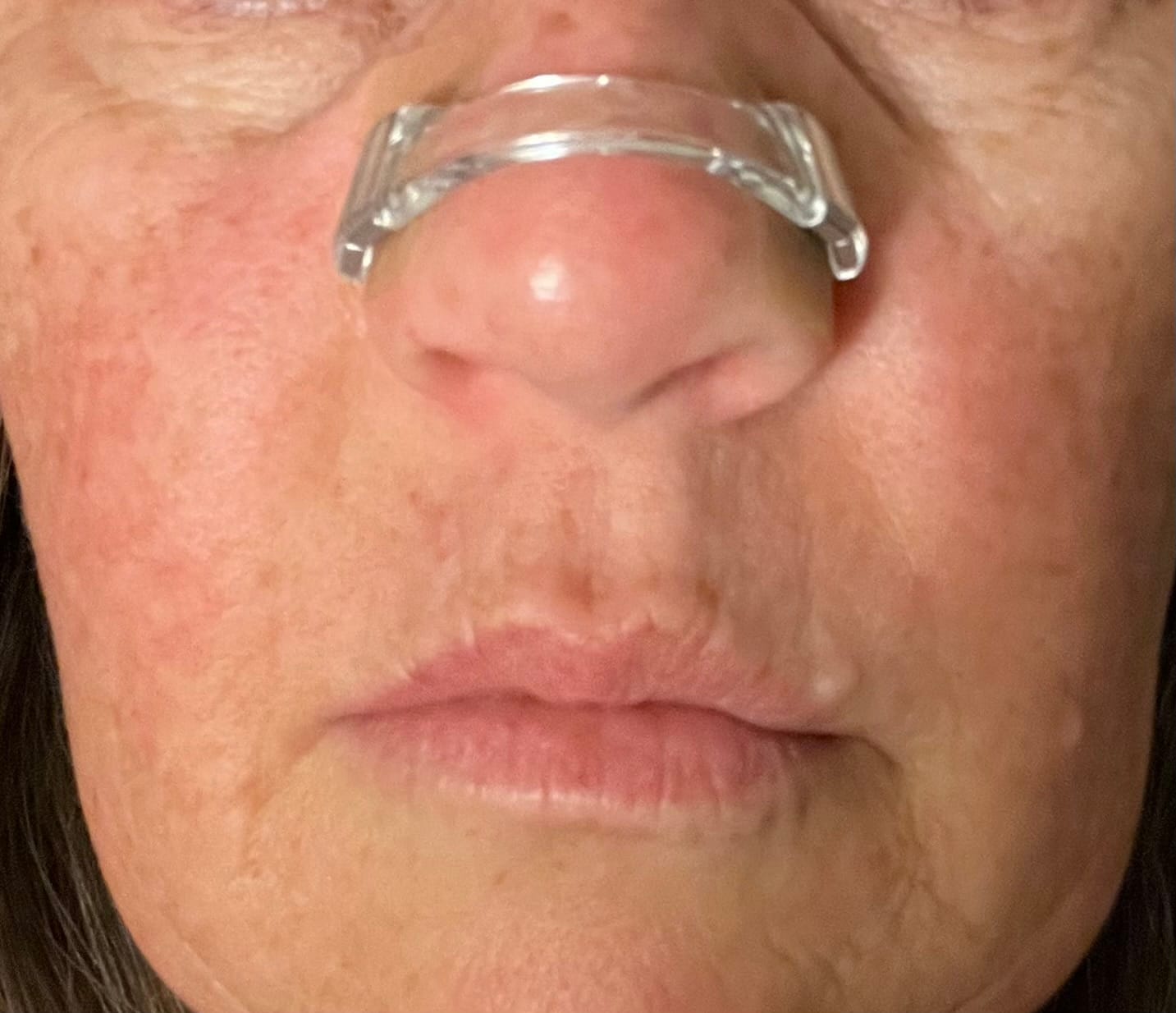 Customer photo review of Refill Plan - 30 Uses